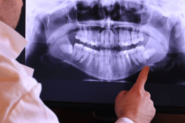 Best Chipped Tooth Repair Near Me  in Lantana, FL